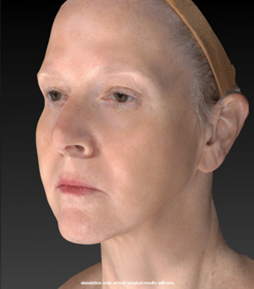 face-sculptor-sb after image