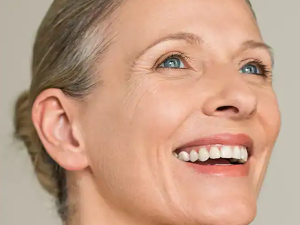 Ultherapy Prime