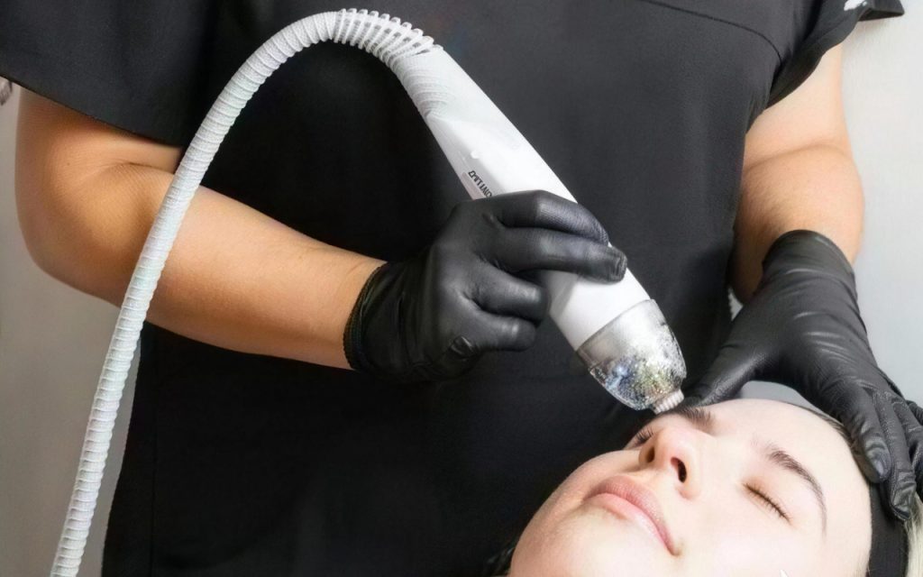 https://stasisclinic.com/endymed-intensif-sydney-advanced-rf-microneedling-skin-treatment-guide/