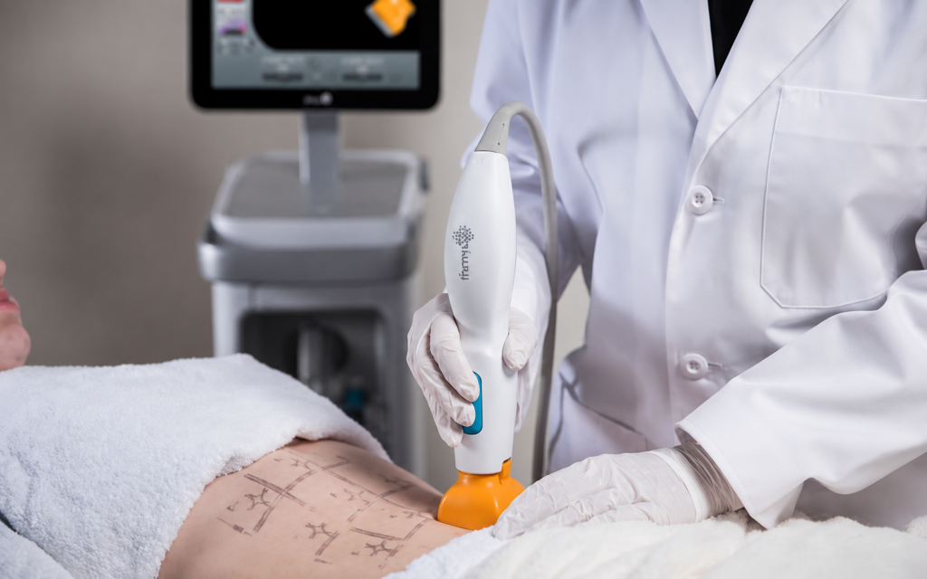 https://stasisclinic.com/thermage-flx-in-sydney-cbd-what-to-expect-before-during-and-after-treatment/