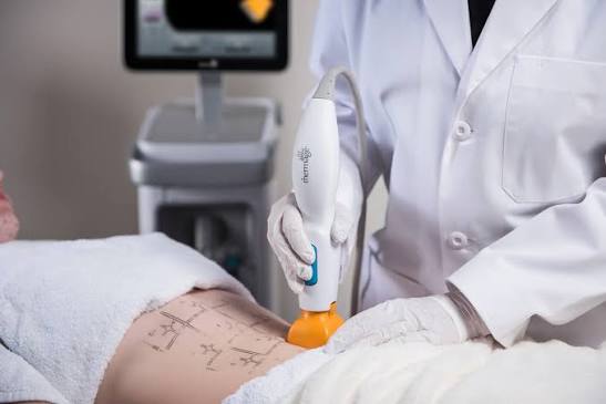 https://stasisclinic.com/thermage-flx-in-sydney-cbd-what-to-expect-before-during-and-after-treatment/