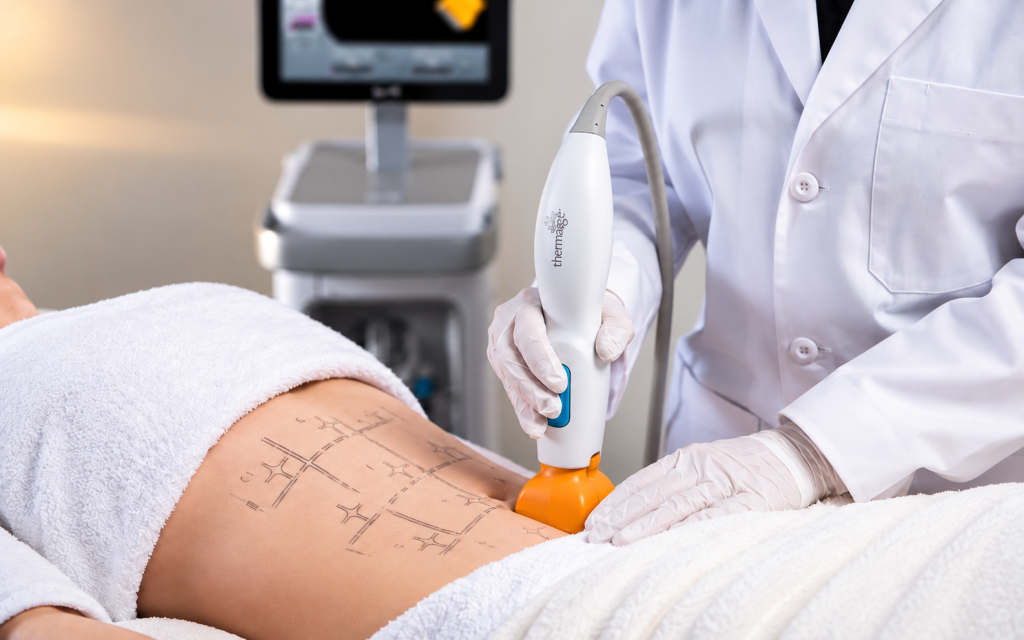 https://stasisclinic.com/thermage-flx-for-skin-firmness-benefits-treatment-areas-and-considerations/